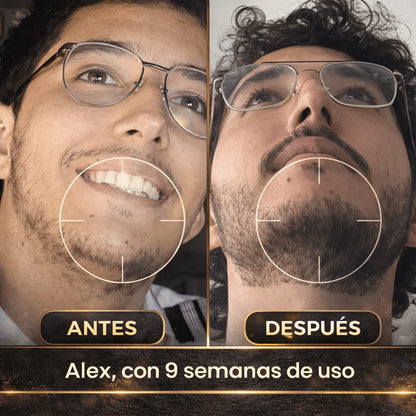 ESTIMULANTE DE BARBA APOLO