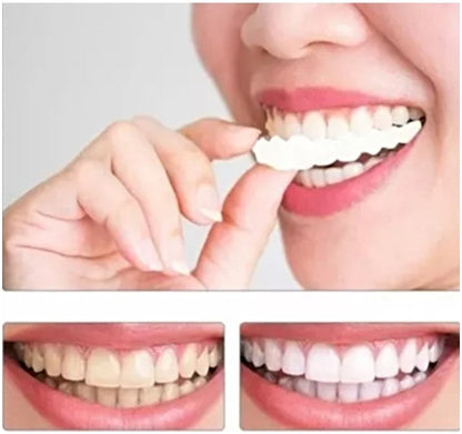 Carillas De Dientes