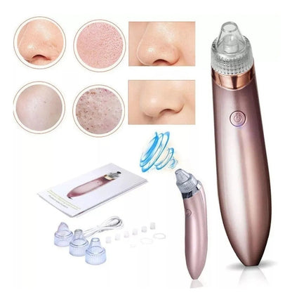 Extractor De Espinillas y Puntos Negros